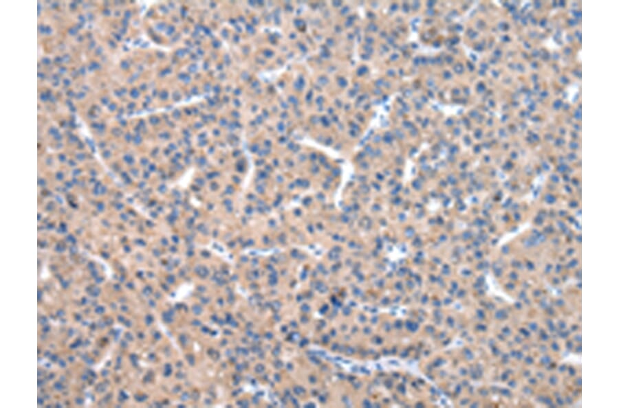 Immunohistochemistry - C10orf2 Antibody from Signalway Antibody (43023) - Antibodies.com