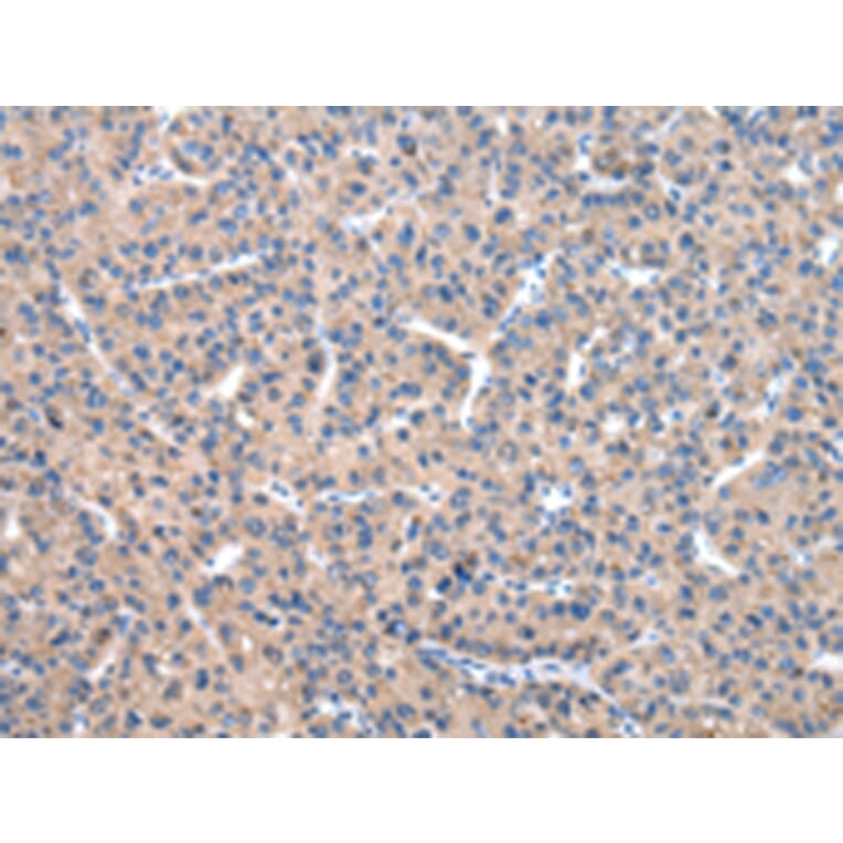 Immunohistochemistry - C10orf2 Antibody from Signalway Antibody (43023) - Antibodies.com