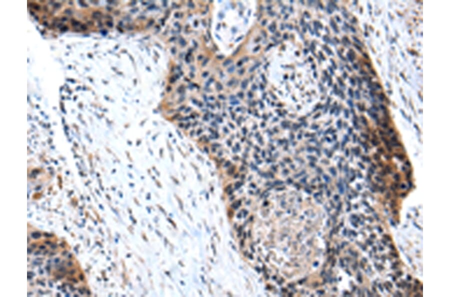 Immunohistochemistry - C10orf2 Antibody from Signalway Antibody (43023) - Antibodies.com