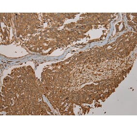 Immunohistochemistry - CYP20A1 Antibody from Signalway Antibody (43065) - Antibodies.com