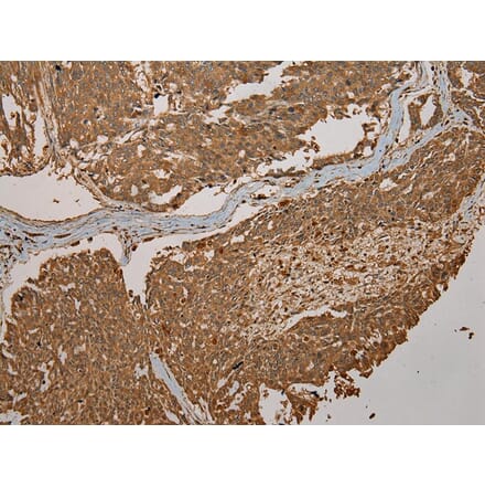 Immunohistochemistry - CYP20A1 Antibody from Signalway Antibody (43065) - Antibodies.com