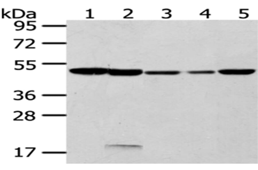 CYP20A1 Antibody from Signalway Antibody (43065) - Antibodies.com