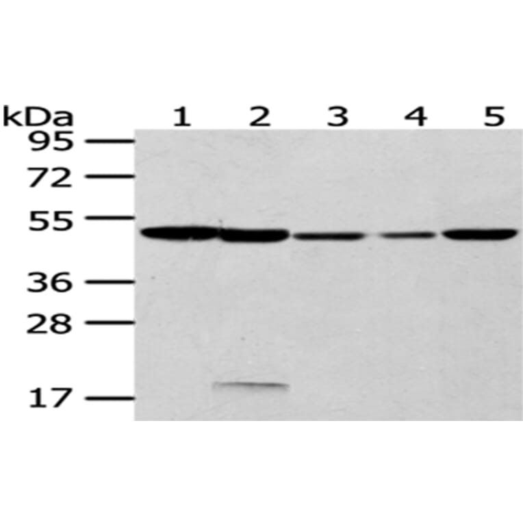 CYP20A1 Antibody from Signalway Antibody (43065) - Antibodies.com