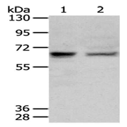 PPP2R1B Antibody from Signalway Antibody (43083) - Antibodies.com