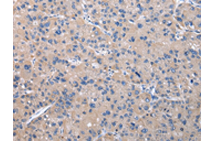 Immunohistochemistry - PPP2R1B Antibody from Signalway Antibody (43083) - Antibodies.com