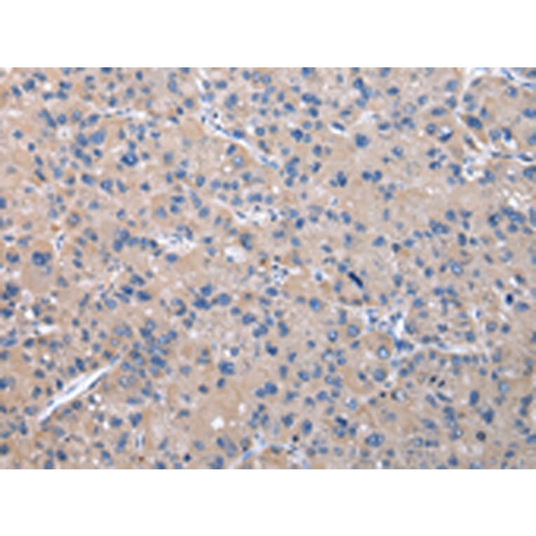 Immunohistochemistry - PPP2R1B Antibody from Signalway Antibody (43083) - Antibodies.com