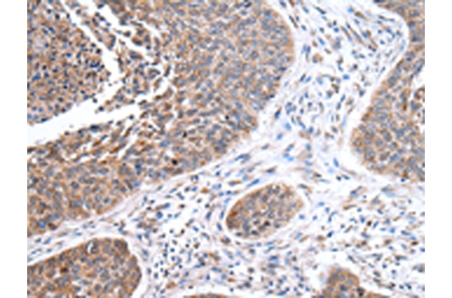 Immunohistochemistry - PPP2R1B Antibody from Signalway Antibody (43083) - Antibodies.com