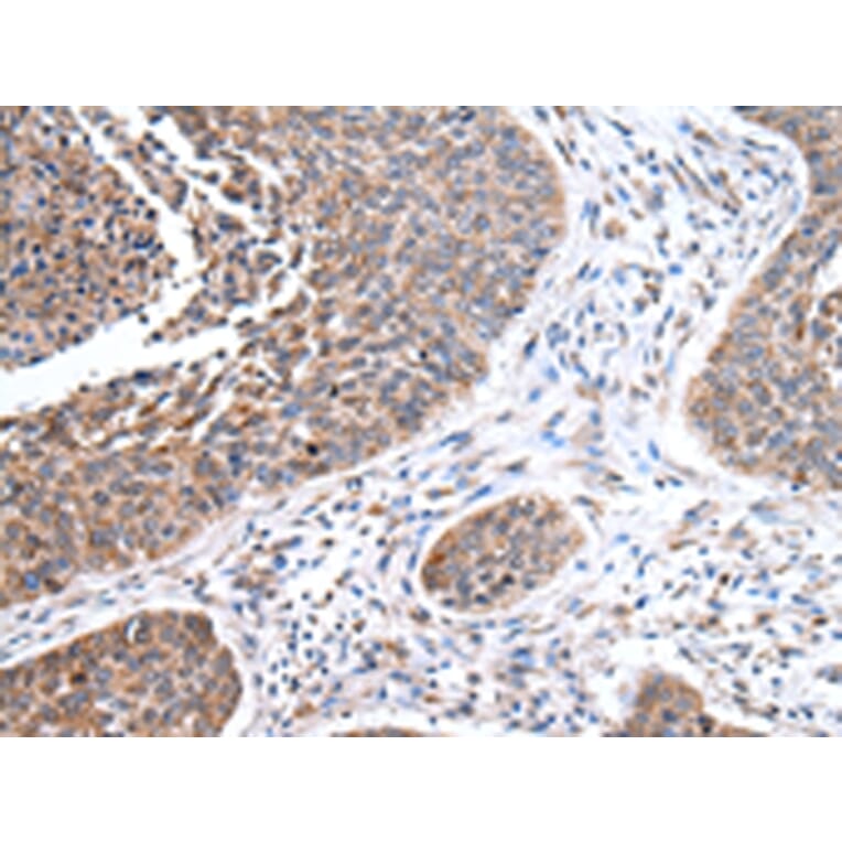 Immunohistochemistry - PPP2R1B Antibody from Signalway Antibody (43083) - Antibodies.com