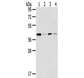 MAGEA11 Antibody from Signalway Antibody (43138) - Antibodies.com