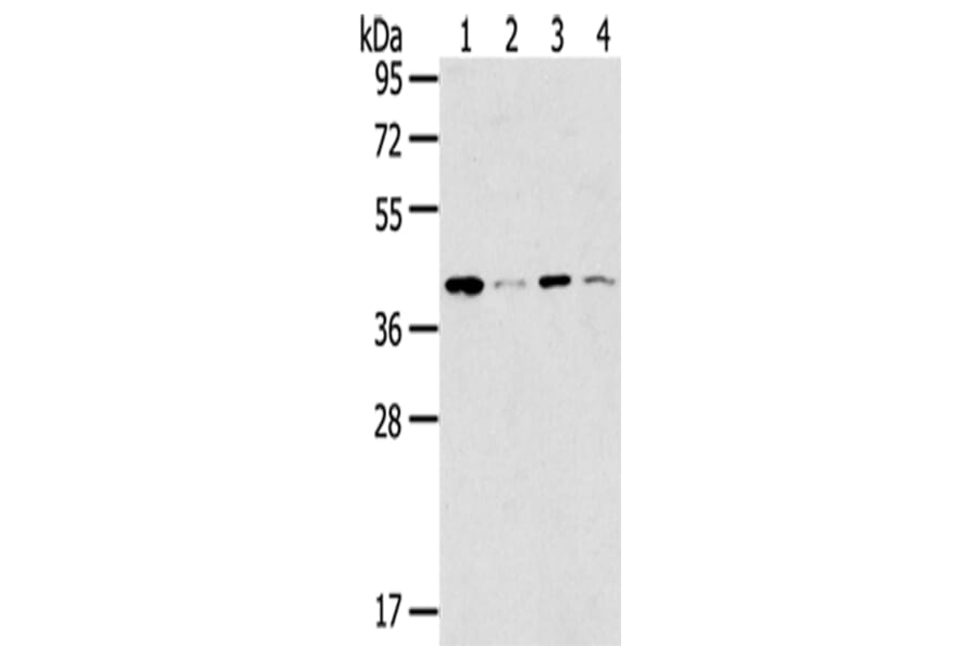 MAGEA11 Antibody from Signalway Antibody (43138) - Antibodies.com