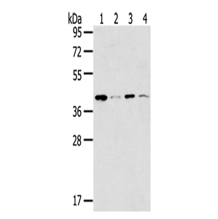 MAGEA11 Antibody from Signalway Antibody (43138) - Antibodies.com