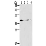 MAGEA11 Antibody from Signalway Antibody (43138) - Antibodies.com