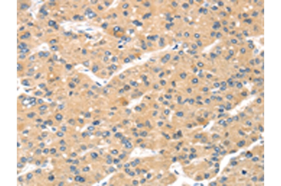 Immunohistochemistry - MAGEA11 Antibody from Signalway Antibody (43138) - Antibodies.com