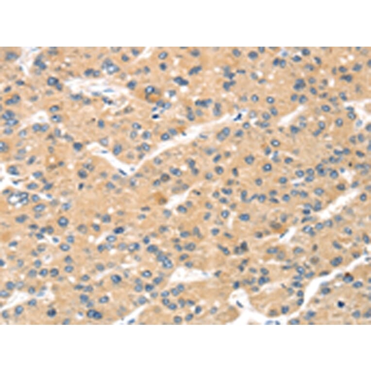 Immunohistochemistry - MAGEA11 Antibody from Signalway Antibody (43138) - Antibodies.com