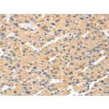 Immunohistochemistry - MAGEA11 Antibody from Signalway Antibody (43138) - Antibodies.com