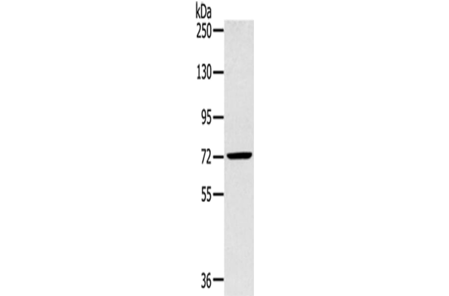SLC27A5 Antibody from Signalway Antibody (43145) - Antibodies.com