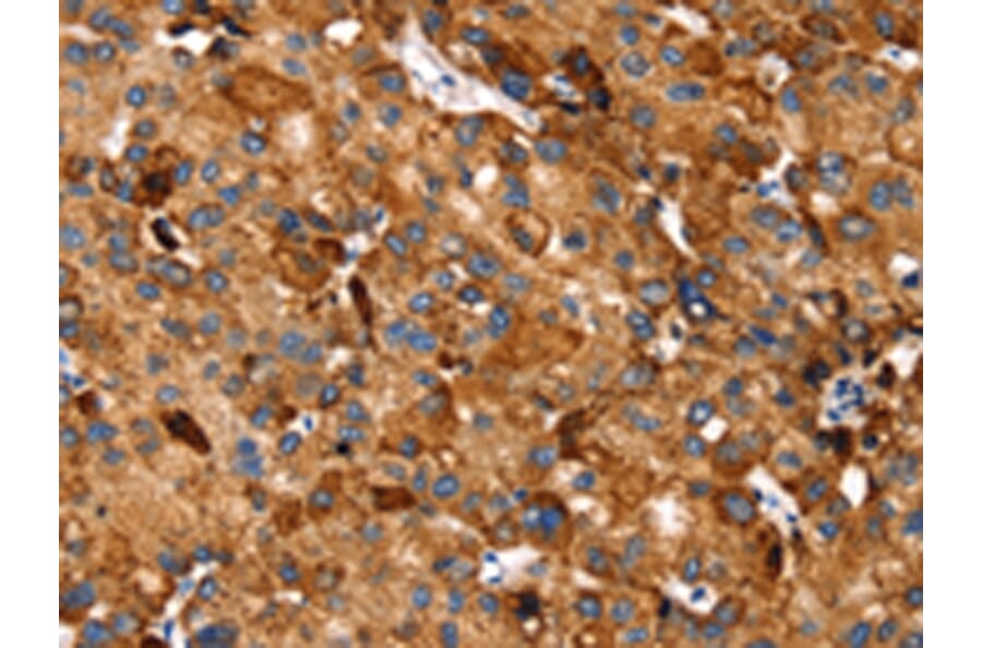 Immunohistochemistry - SLC27A5 Antibody from Signalway Antibody (43145) - Antibodies.com