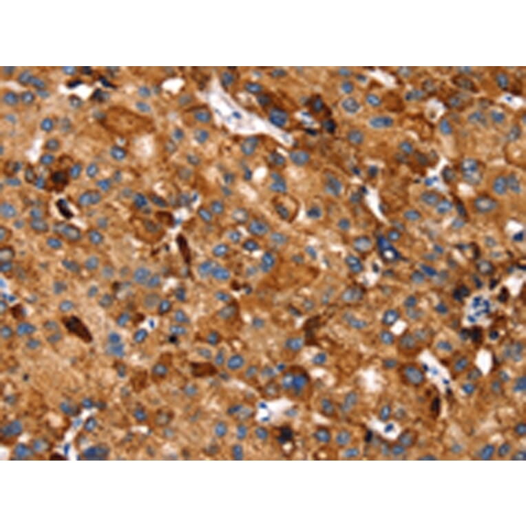 Immunohistochemistry - SLC27A5 Antibody from Signalway Antibody (43145) - Antibodies.com