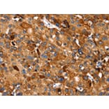 Immunohistochemistry - SLC27A5 Antibody from Signalway Antibody (43145) - Antibodies.com