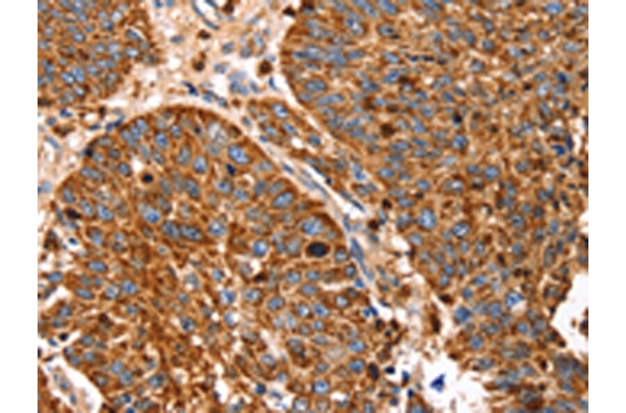 Immunohistochemistry - SLC27A5 Antibody from Signalway Antibody (43145) - Antibodies.com