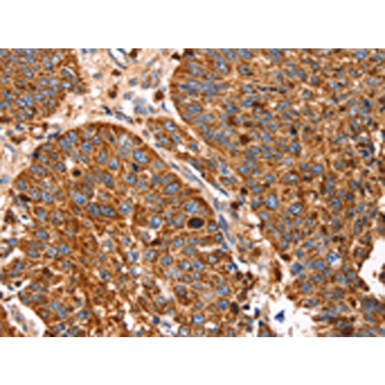 Immunohistochemistry - SLC27A5 Antibody from Signalway Antibody (43145) - Antibodies.com