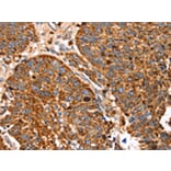 Immunohistochemistry - SLC27A5 Antibody from Signalway Antibody (43145) - Antibodies.com