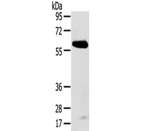 SPATA18 Antibody from Signalway Antibody (43147) - Antibodies.com