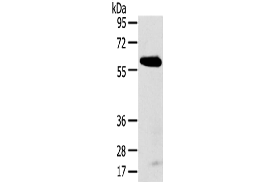 SPATA18 Antibody from Signalway Antibody (43147) - Antibodies.com