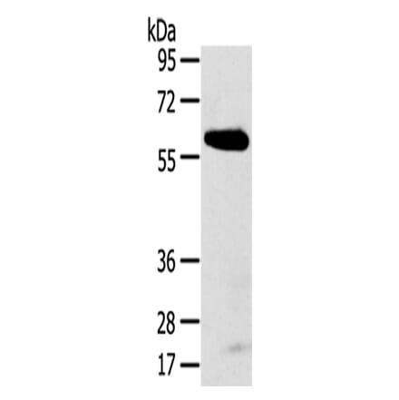 SPATA18 Antibody from Signalway Antibody (43147) - Antibodies.com