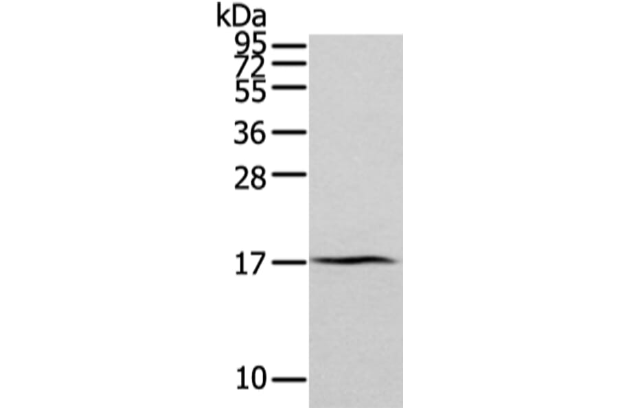 ZFAND2A Antibody from Signalway Antibody (43205) - Antibodies.com