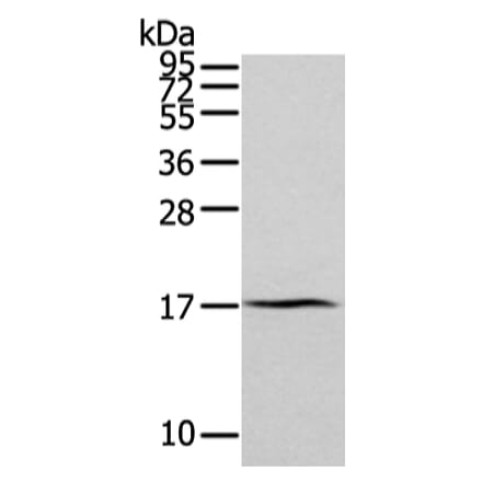 ZFAND2A Antibody from Signalway Antibody (43205) - Antibodies.com