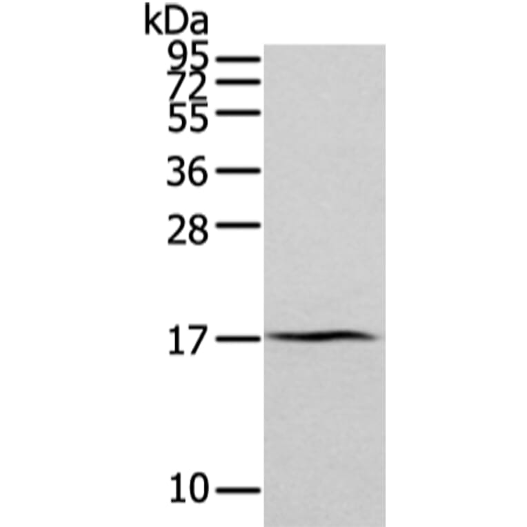 ZFAND2A Antibody from Signalway Antibody (43205) - Antibodies.com