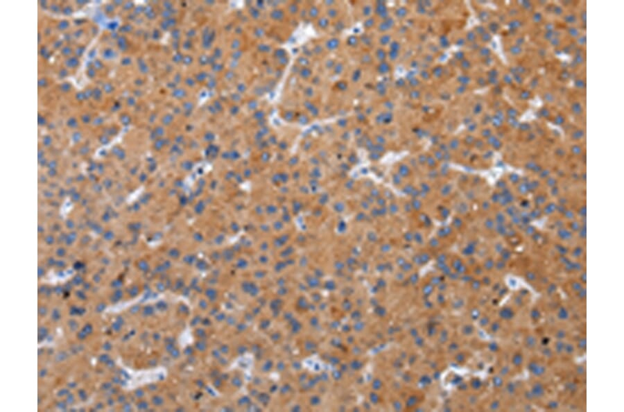 Immunohistochemistry - ZFAND2A Antibody from Signalway Antibody (43205) - Antibodies.com