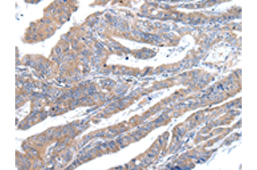 Immunohistochemistry - ZFAND2A Antibody from Signalway Antibody (43205) - Antibodies.com