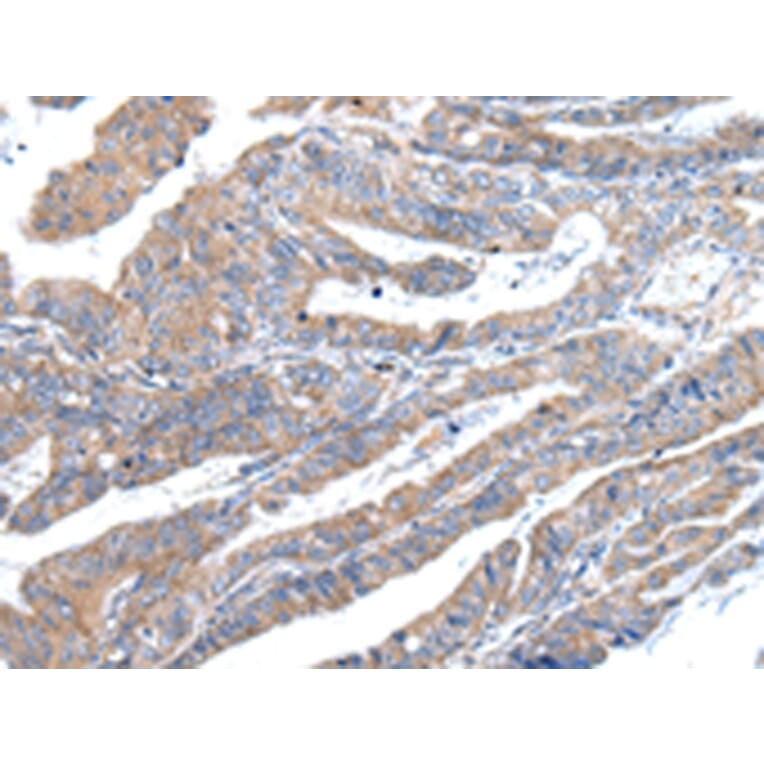 Immunohistochemistry - ZFAND2A Antibody from Signalway Antibody (43205) - Antibodies.com