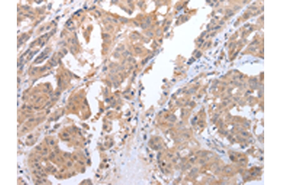 Immunohistochemistry - ATG16L1 Antibody from Signalway Antibody (43247) - Antibodies.com