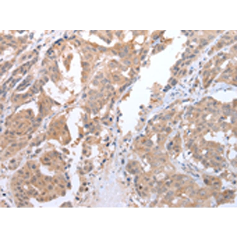 Immunohistochemistry - ATG16L1 Antibody from Signalway Antibody (43247) - Antibodies.com