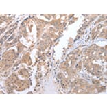 Immunohistochemistry - ATG16L1 Antibody from Signalway Antibody (43247) - Antibodies.com