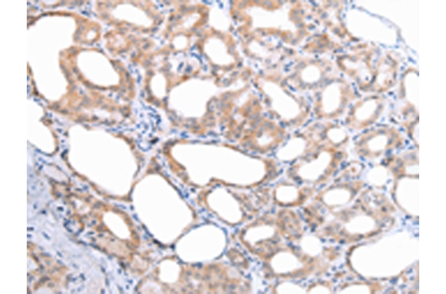 Immunohistochemistry - ATG16L1 Antibody from Signalway Antibody (43247) - Antibodies.com