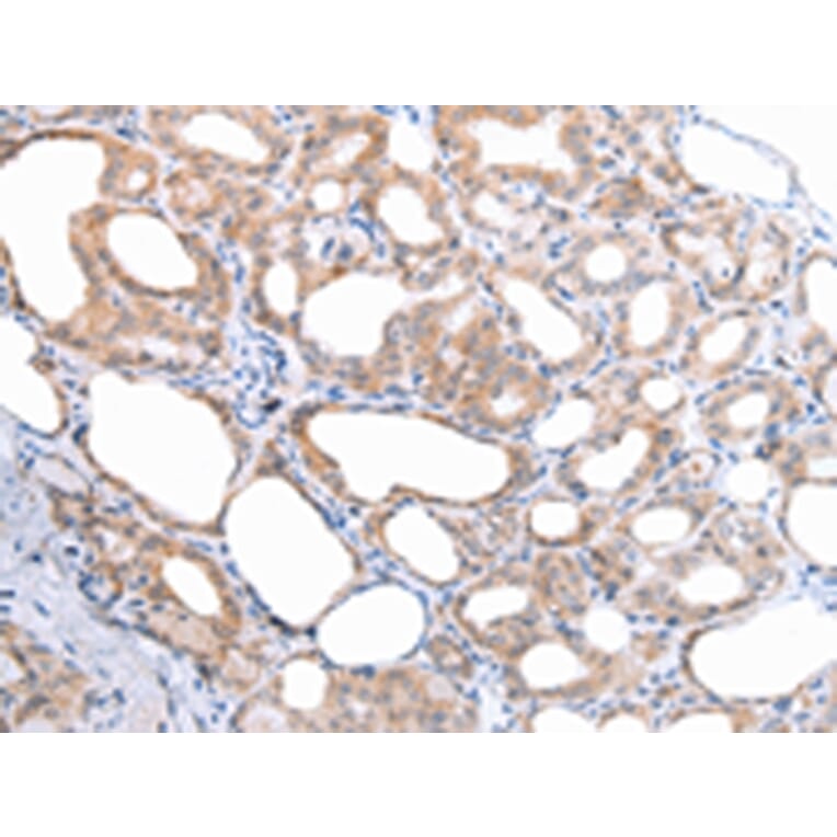 Immunohistochemistry - ATG16L1 Antibody from Signalway Antibody (43247) - Antibodies.com