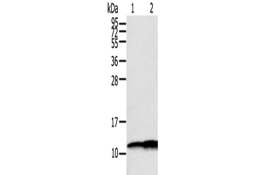 S100A11 Antibody from Signalway Antibody (43327) - Antibodies.com