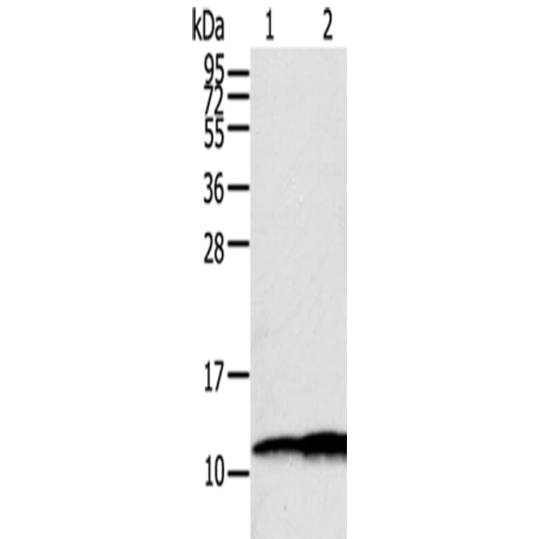 S100A11 Antibody from Signalway Antibody (43327) - Antibodies.com