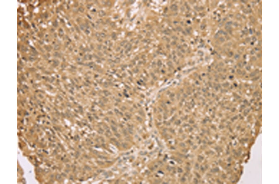 Immunohistochemistry - S100A11 Antibody from Signalway Antibody (43327) - Antibodies.com