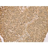 Immunohistochemistry - S100A11 Antibody from Signalway Antibody (43327) - Antibodies.com