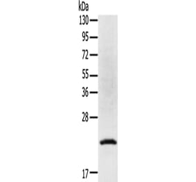 TP53I11 Antibody from Signalway Antibody (43423) - Antibodies.com