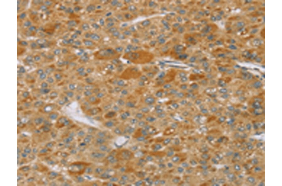 Immunohistochemistry - TP53I11 Antibody from Signalway Antibody (43423) - Antibodies.com