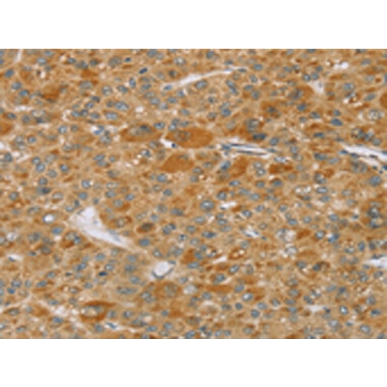 Immunohistochemistry - TP53I11 Antibody from Signalway Antibody (43423) - Antibodies.com
