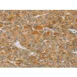 Immunohistochemistry - TP53I11 Antibody from Signalway Antibody (43423) - Antibodies.com