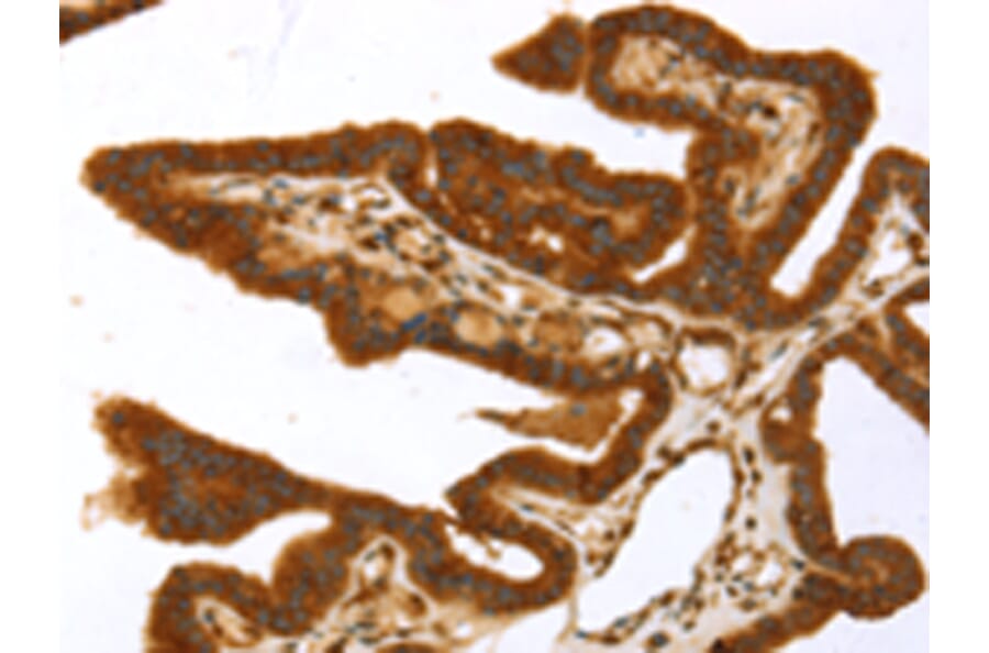 Immunohistochemistry - TP53I11 Antibody from Signalway Antibody (43423) - Antibodies.com