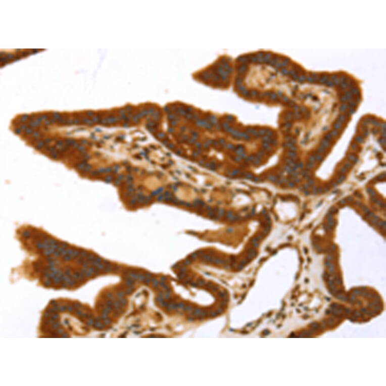 Immunohistochemistry - TP53I11 Antibody from Signalway Antibody (43423) - Antibodies.com